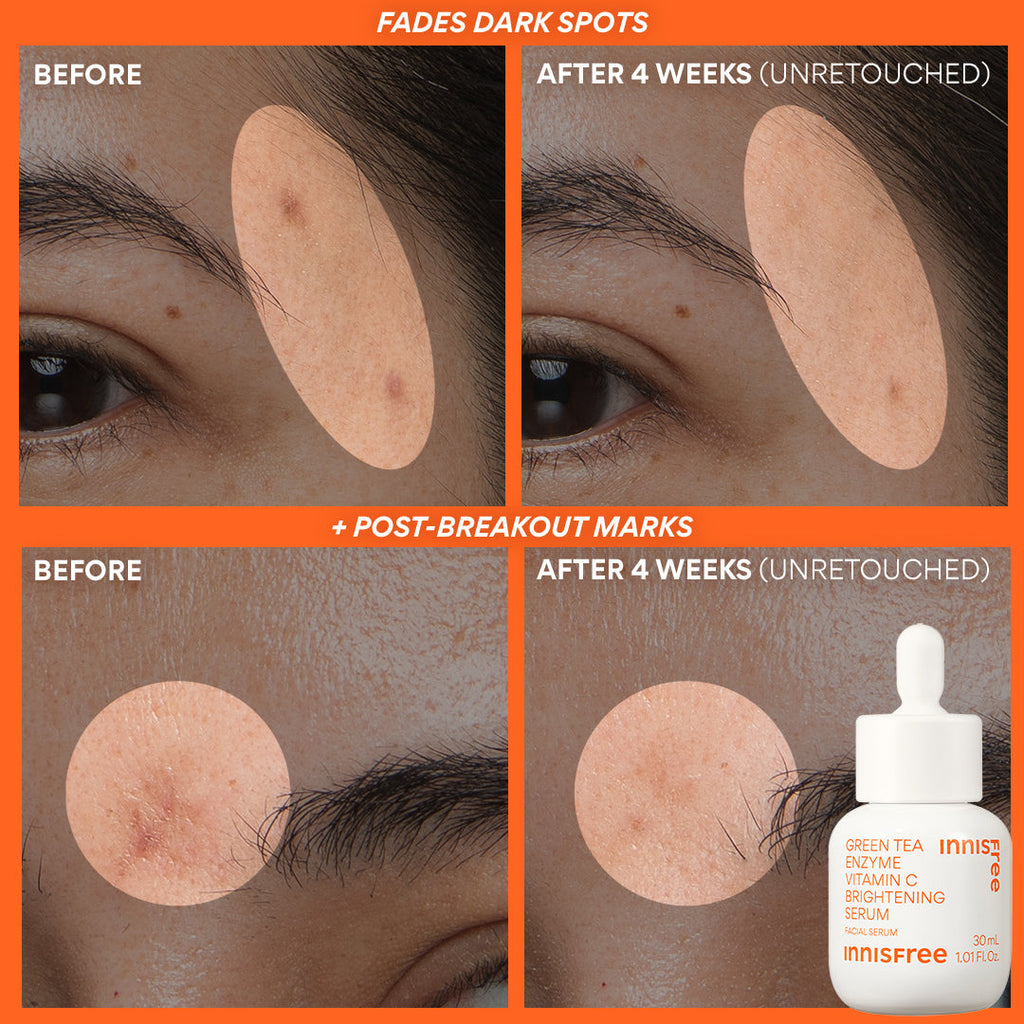 Innisfree Rapid Radiance Set