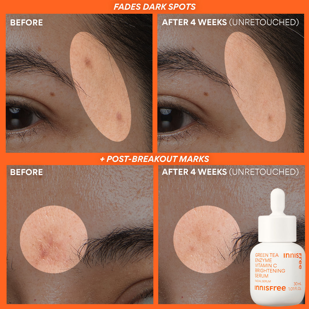 Innisfree Rapid Radiance Set