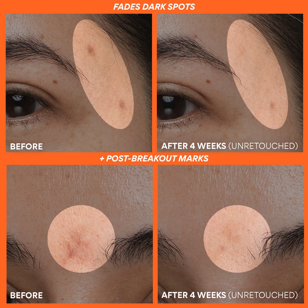 Innisfree Dewy Skin Kit