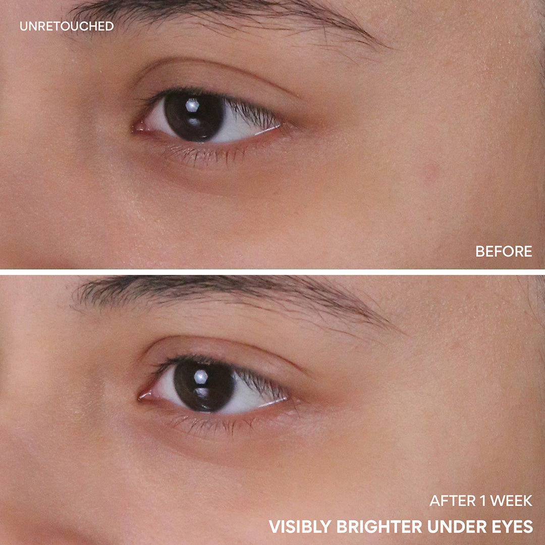 Innisfree Vitamin C Niacinamide Brightening Eye Serum